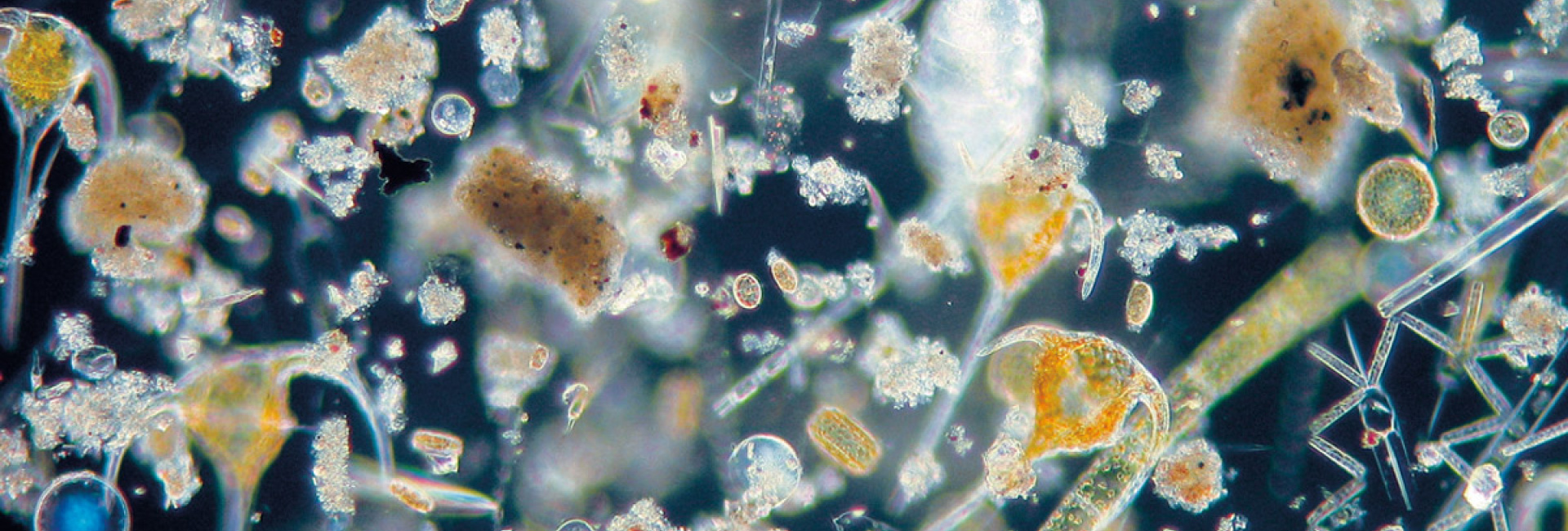 Phytoplankton. Foto: Annegeret Stuhr/ GEOMAR