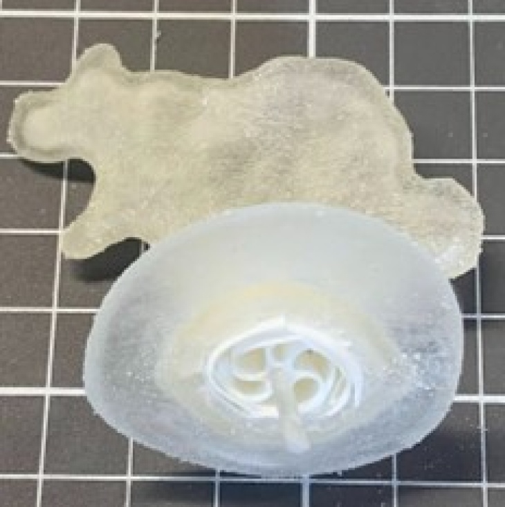 3D-gedruckter patientenspezifischer linker Vorhofanhang mit eingesetztem Okkluder.
