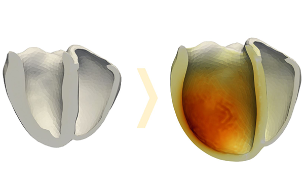 Ein mit der Software 4C simuliertes Herz (in aufgeschnittener Darstellung): links im gesunden Zustand und rechts mit aufgeweiteter Herzkammer aufgrund von Gewebeveränderungen ausgelöst durch Bluthochdruck. Farblich ist der lokale Massenzuwachs im Gewebe dargestellt. Der simulierte Zeitraum beträgt 600 Tage. Quelle: Amadeus M. Gebauer, LNM, TUM 
