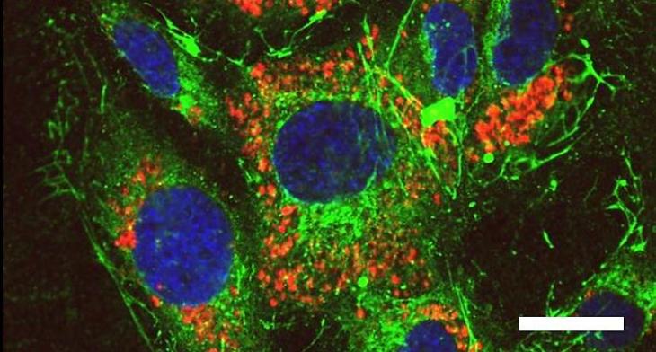 Mikroskopische Aufnahmen einer Endothelzellkultur nach Inkubation mit Nanopartikeln - Rhodamin B gefärbte Nanopartikelaggregate (rot), Zellkerne (blau), Extrazellulärmatrixprotein Fibronektin (grün)/ Konfokale Laser Scanning Mikroskopie/ Maßstabsbalken entspricht 20 µm. Foto: Hereon Endothelzellkultur nach Inkubation mit Nanopartikeln