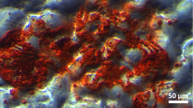 Osteogenic differentiation of human bone marrow mesenchymal stem cells (hBMSCs) on poly(styrene-co-acrylonitrile) surface with micro-scale roughness. (Bone cell-specific markers in red: alizarin red S) 