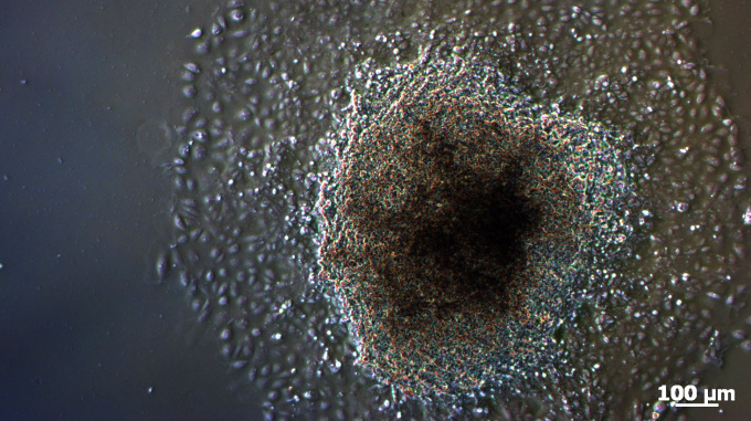 Beating area in the middle of murine embryoid body (EB) on polyetherurethane surface.