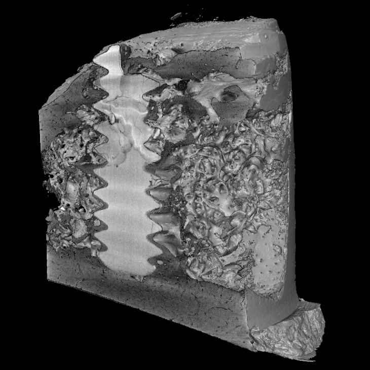 3D Rendering eines Schraubenimplantats